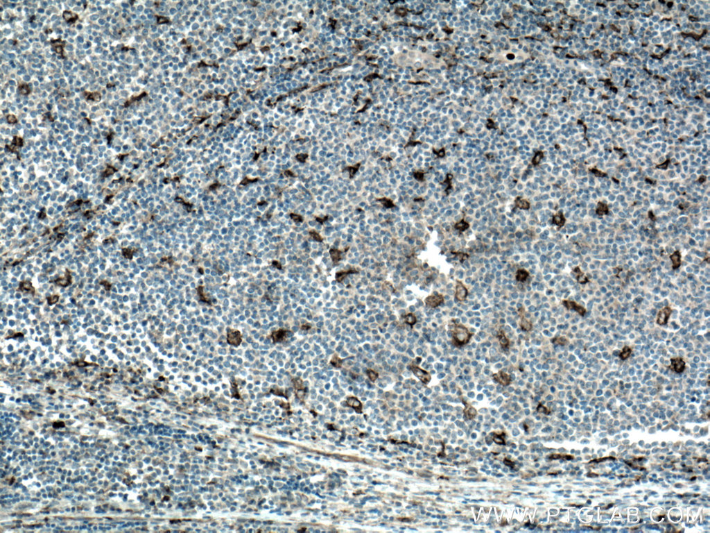 MMP9 (Middle) Polyclonal antibody