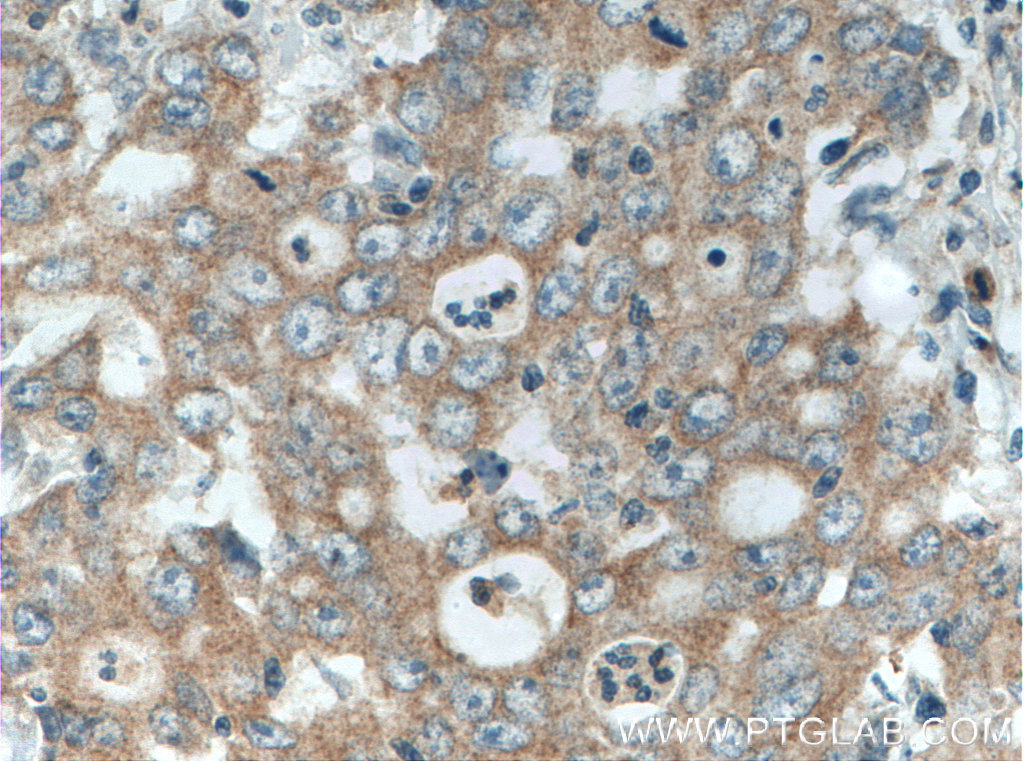 EDEM3 Polyclonal antibody