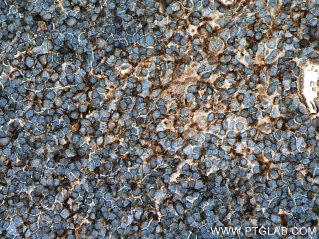 AAGAB Polyclonal antibody