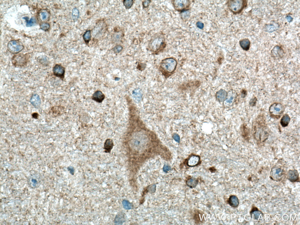 Beta Amyloid Polyclonal antibody