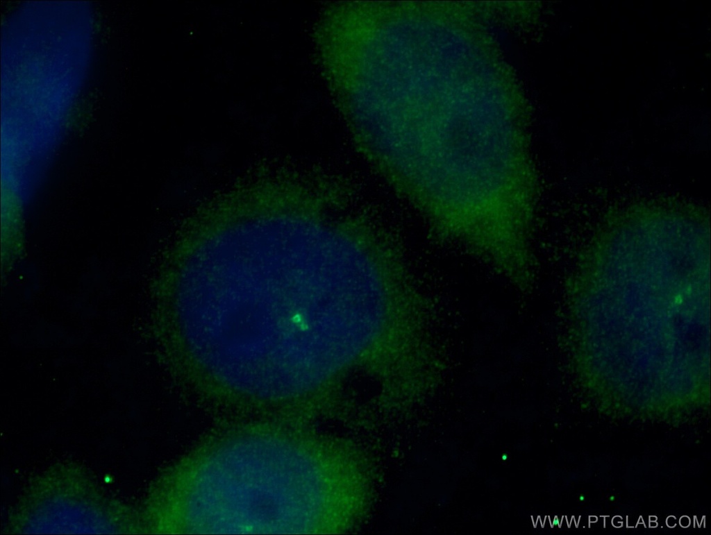 CEP170 Polyclonal antibody