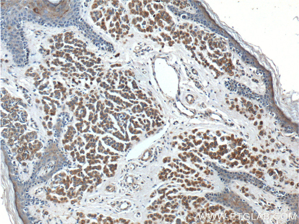SILV Polyclonal antibody