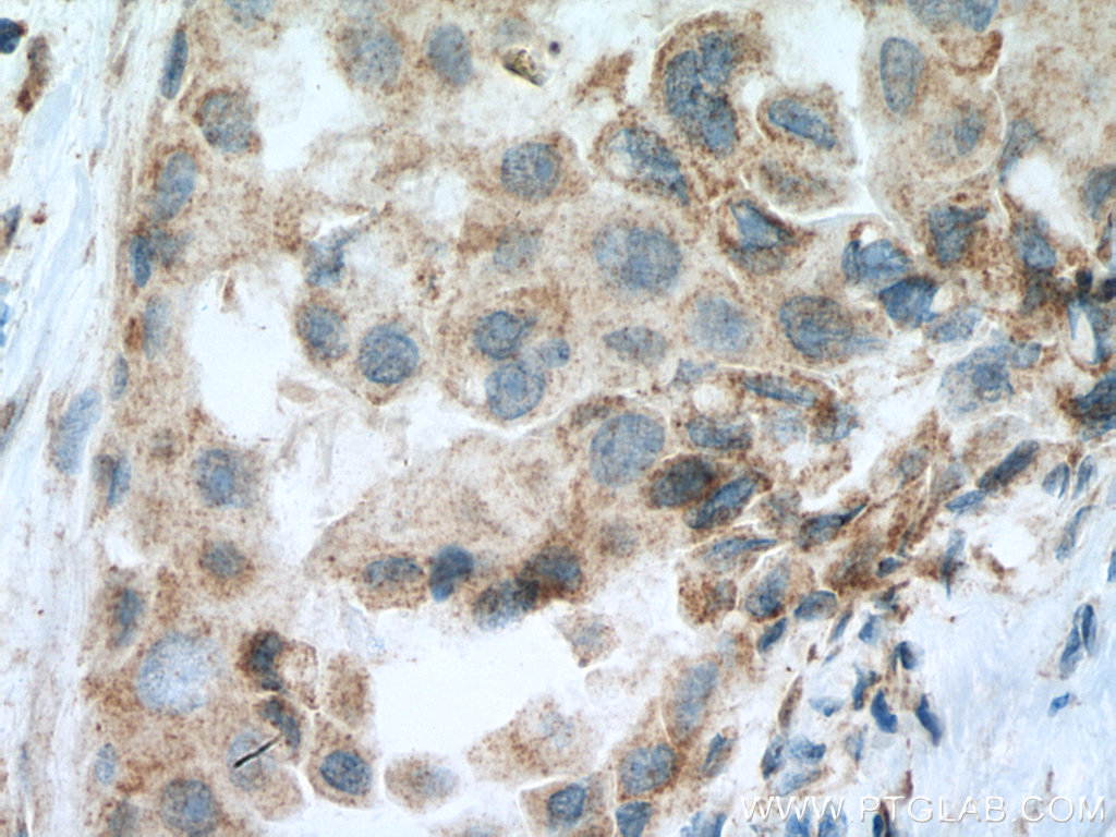 SEMA4A Polyclonal antibody