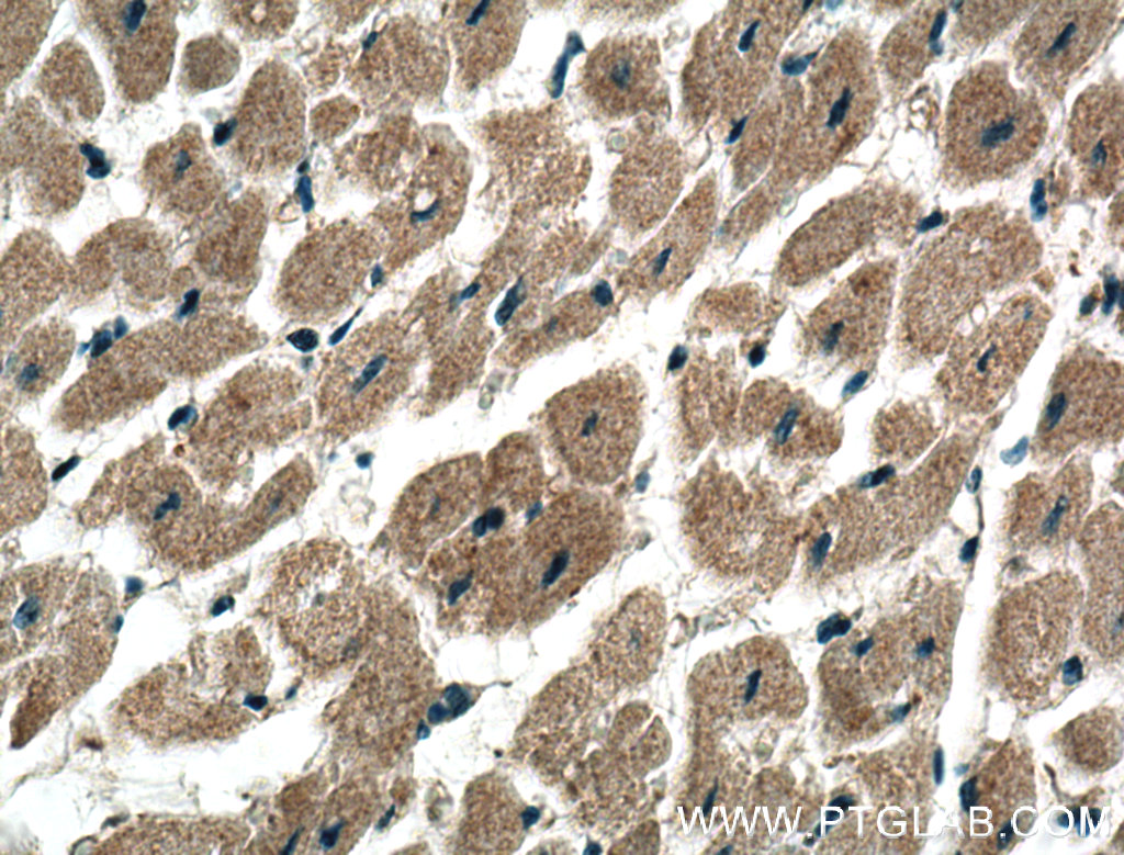 ADAL Polyclonal antibody