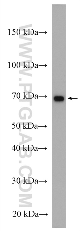 IL-2RG Polyclonal antibody