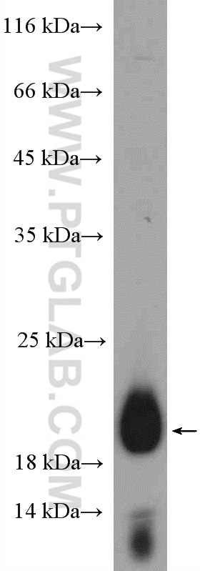 C19orf12 Polyclonal antibody
