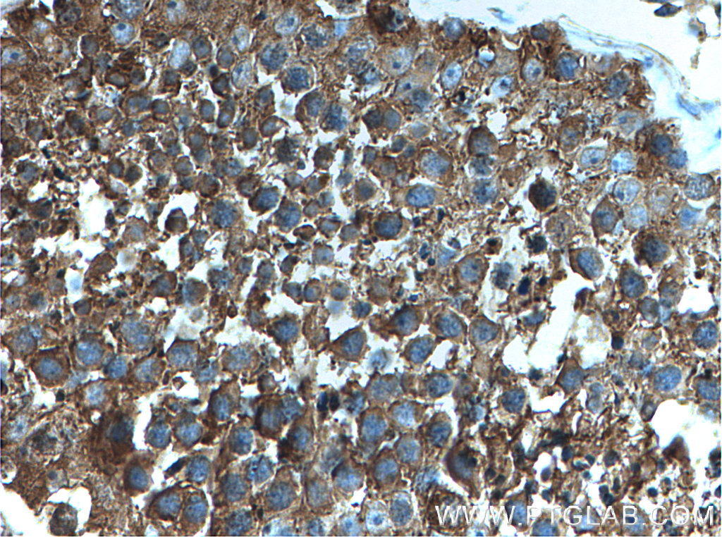 PRKACA Polyclonal antibody