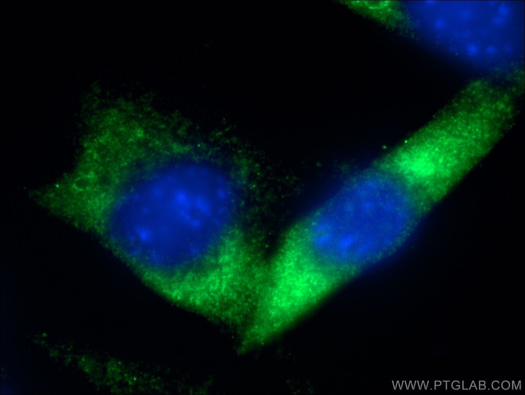 RAB5B Polyclonal antibody