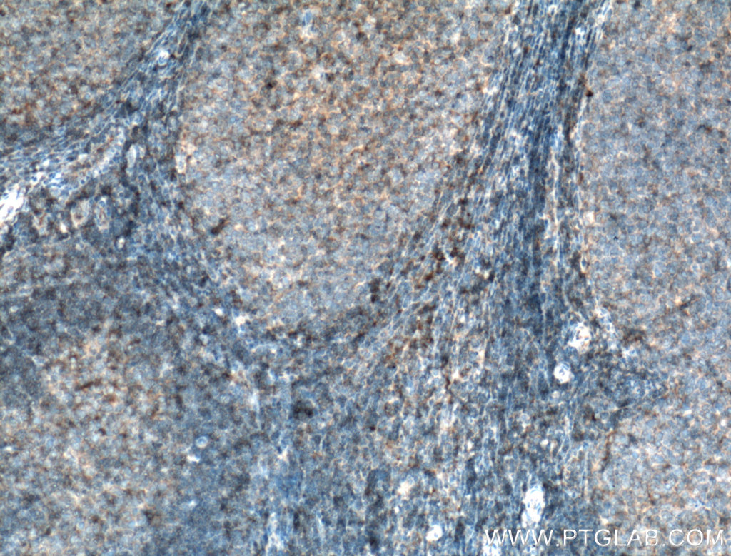 HLA-E Polyclonal antibody