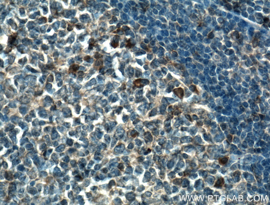 TSEPA Polyclonal antibody