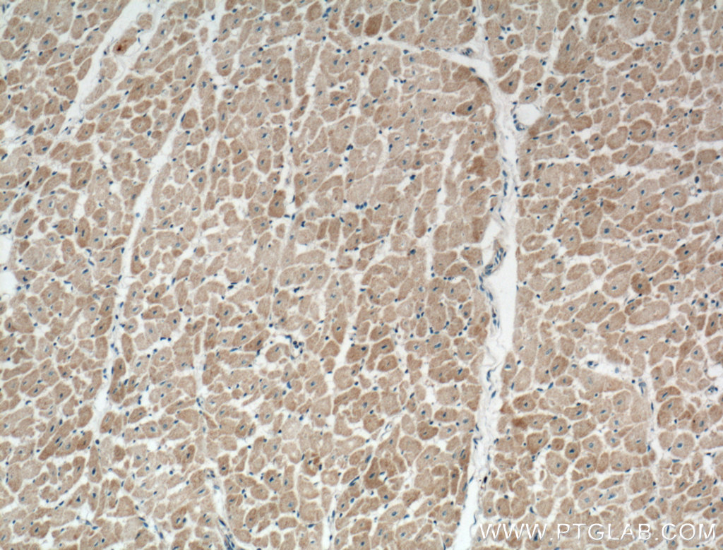 NPPA Polyclonal antibody