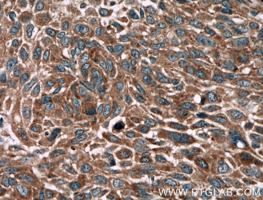 BRAP Polyclonal antibody