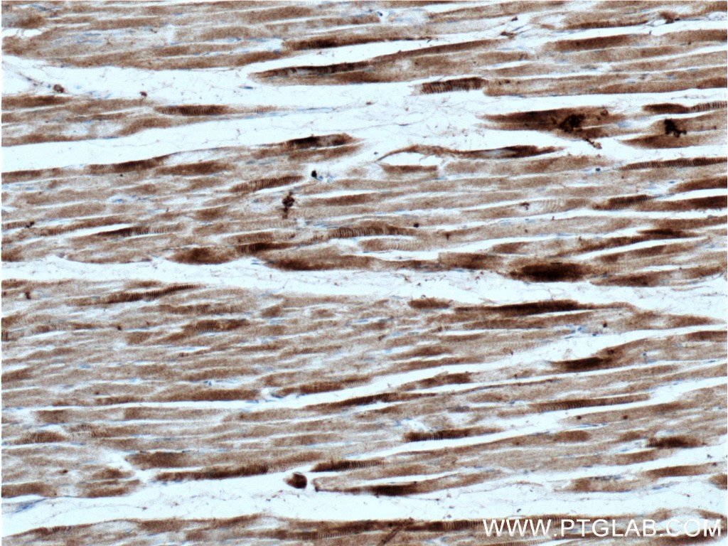 CACNA2D1 Polyclonal antibody