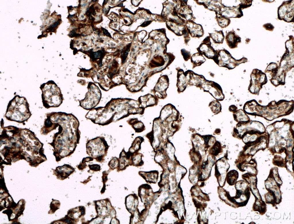 GDF15 Polyclonal antibody