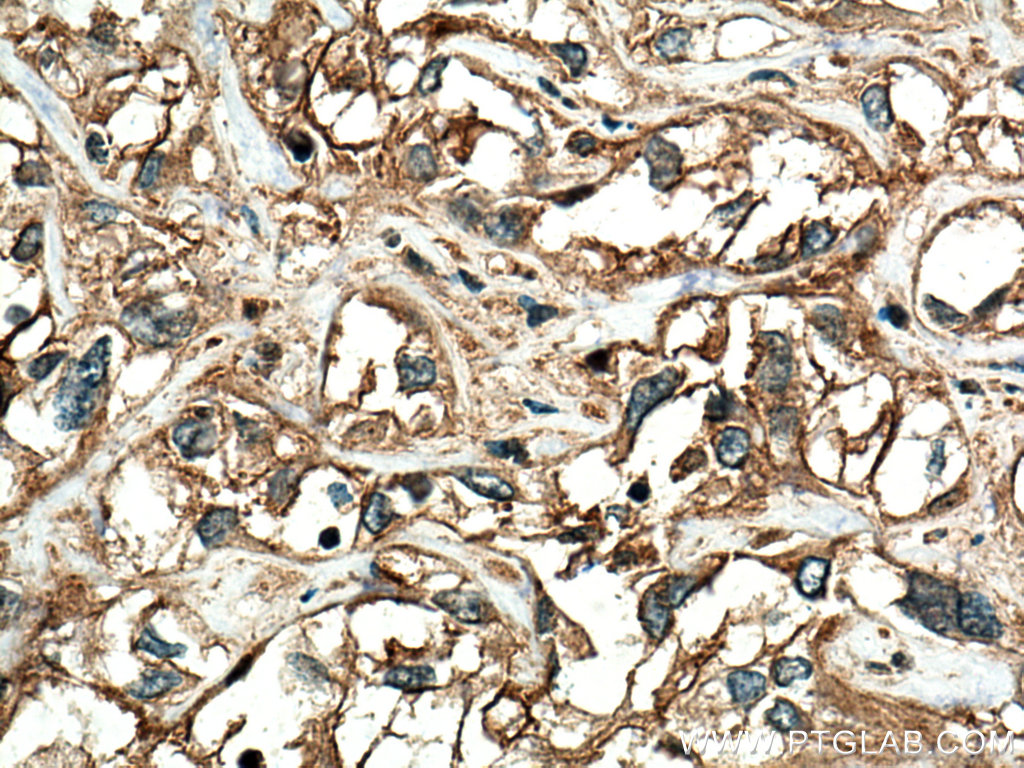 RRAS Polyclonal antibody