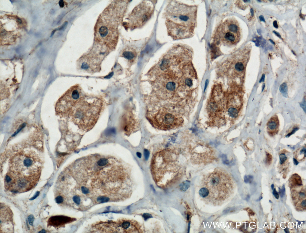 TRIM8 Polyclonal antibody