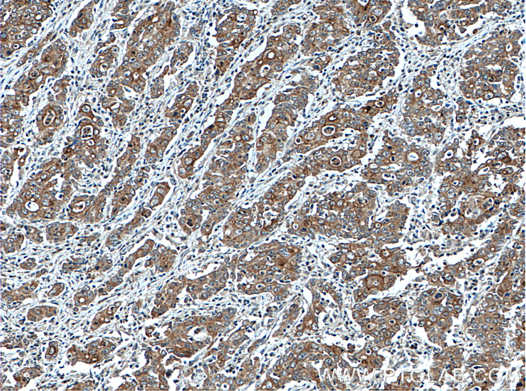 ATG4A Polyclonal antibody