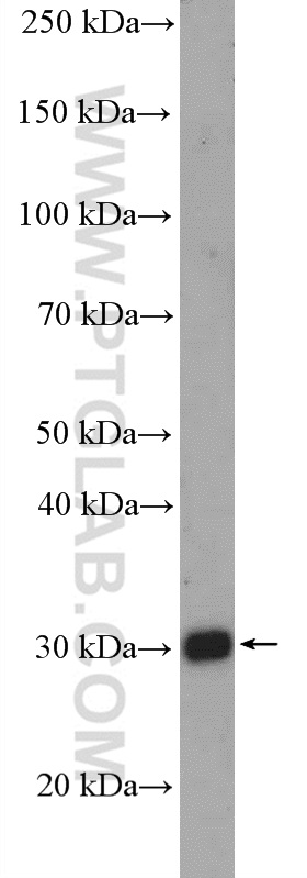 PEX26 Polyclonal antibody