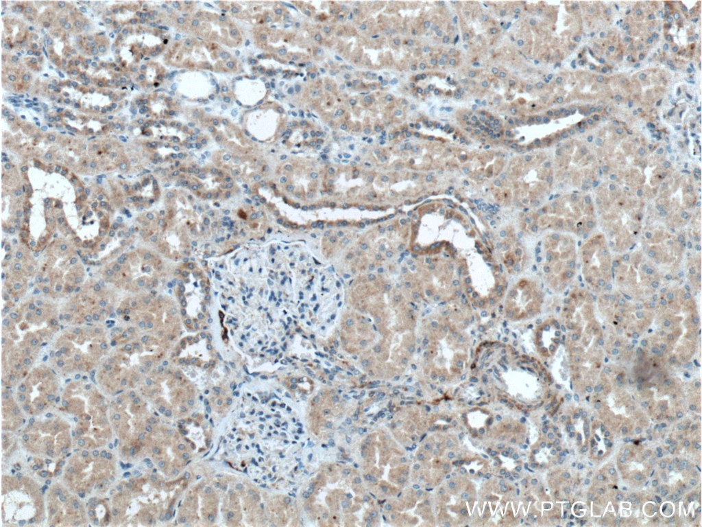 Kininogen 1 Polyclonal antibody