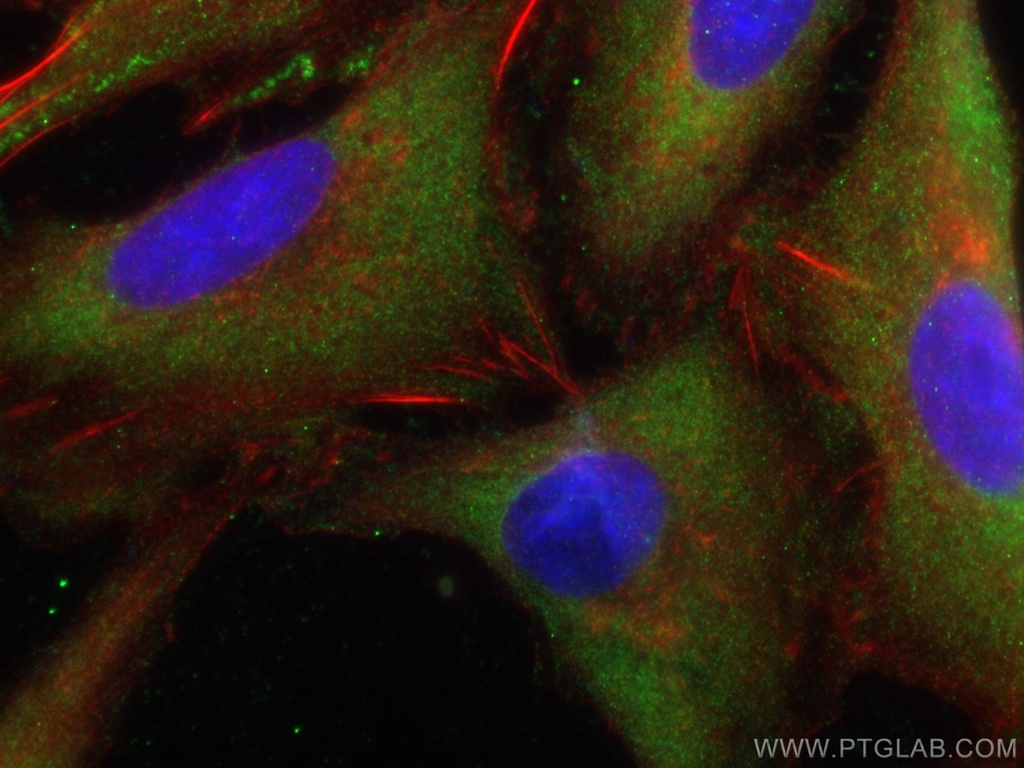 KLHL25 Polyclonal antibody