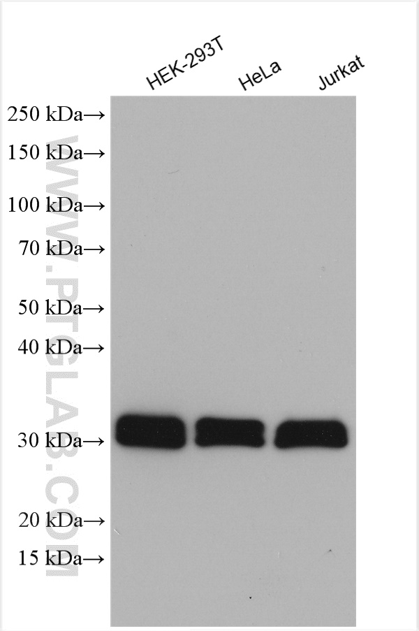 TMX1 Polyclonal antibody