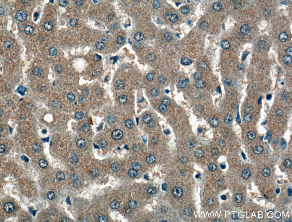 PDXP Polyclonal antibody