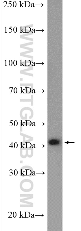 Reticulocalbin 3 Polyclonal antibody