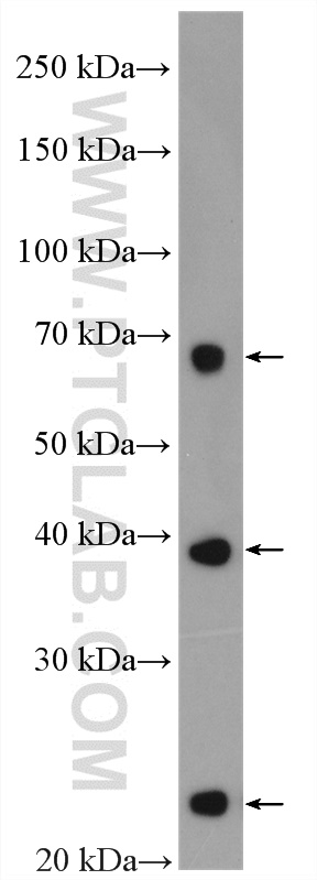SLC31A1 Polyclonal antibody