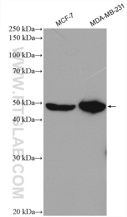 PEX10 Polyclonal antibody