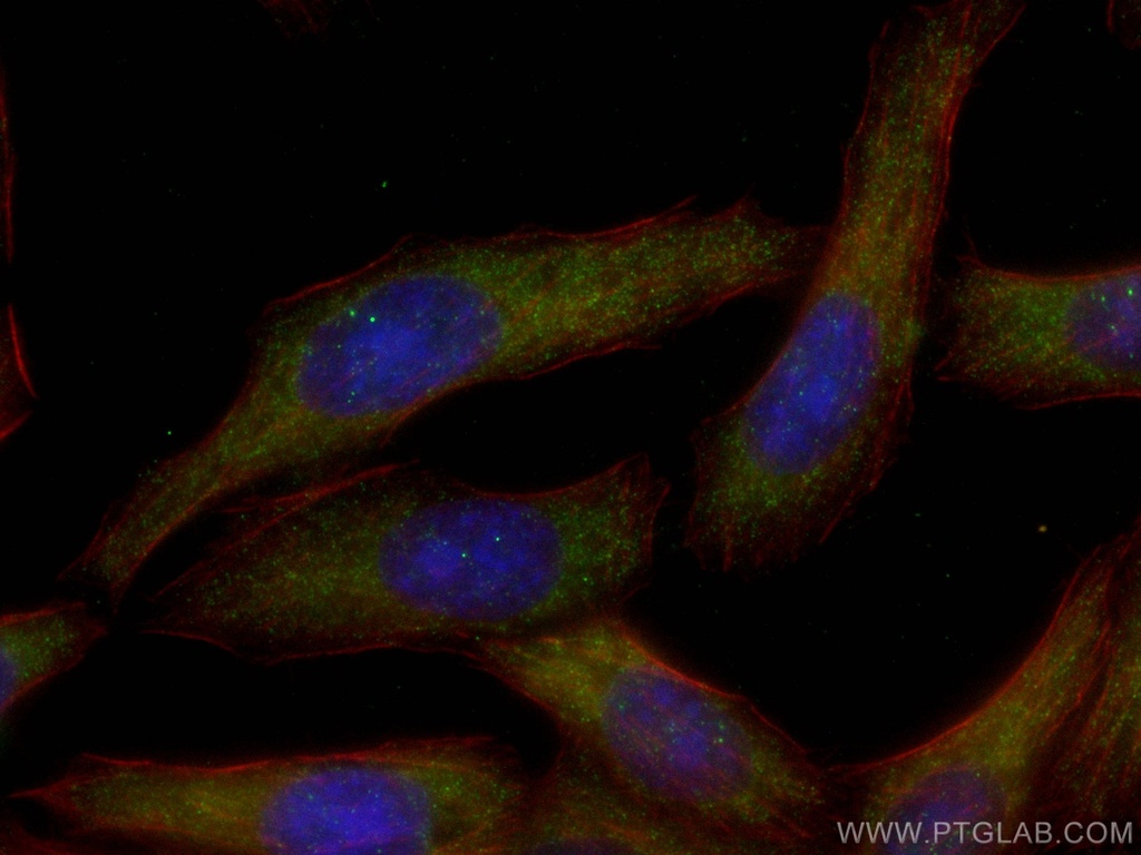 IFN Beta Polyclonal antibody