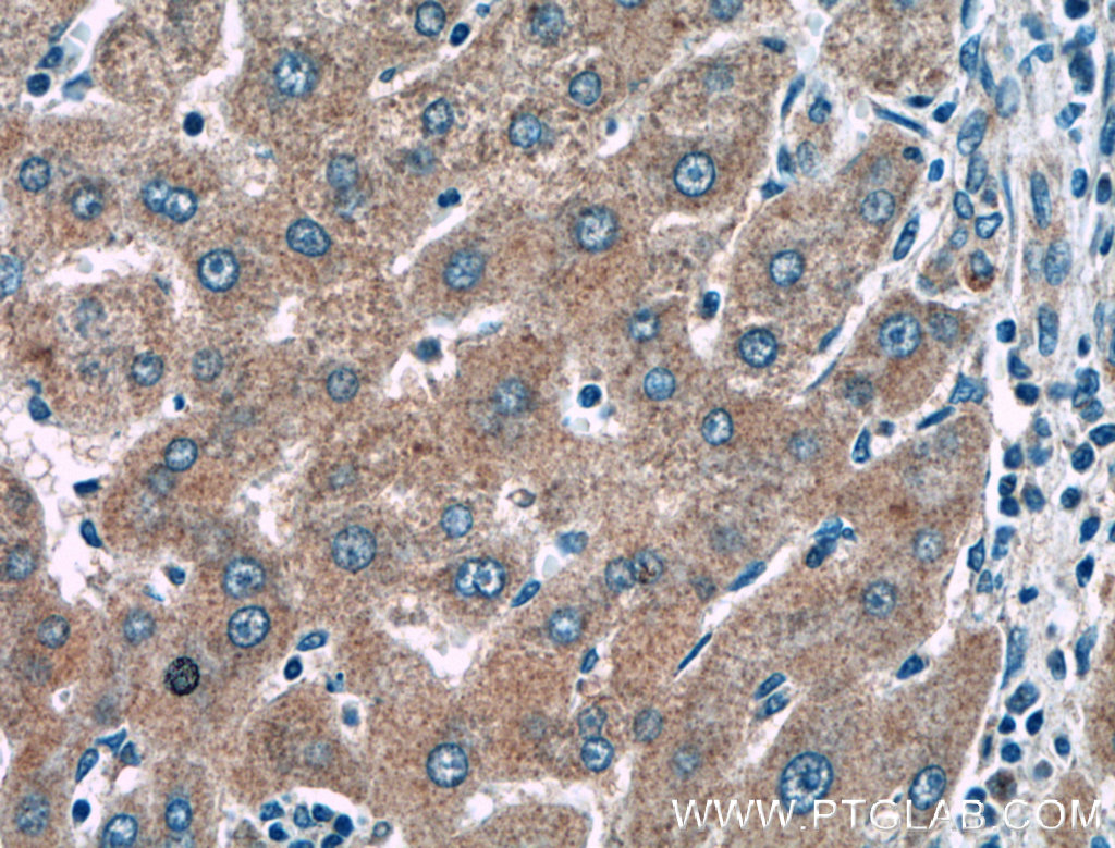 KLK15 Polyclonal antibody