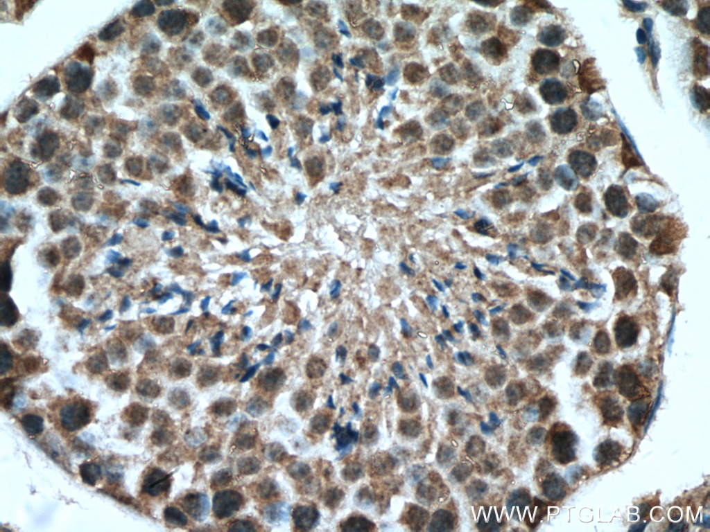 USP29 Polyclonal antibody