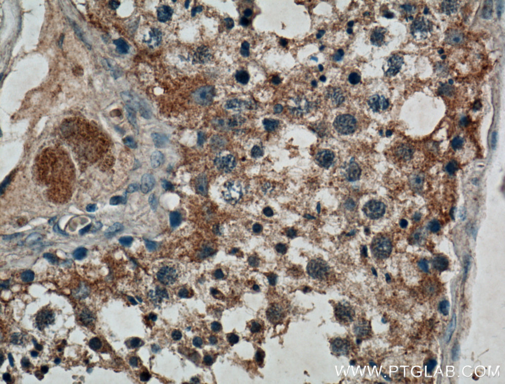 IRE1; ERN1 Polyclonal antibody