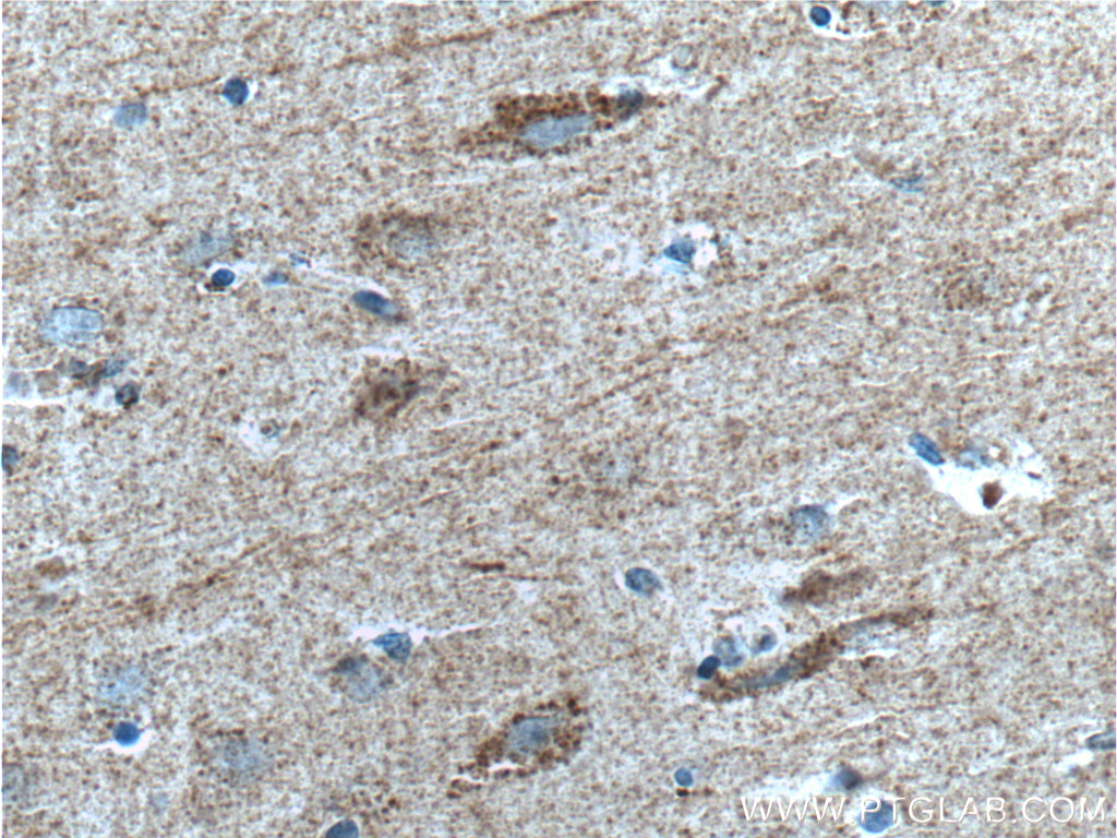 SYNDIG1 Polyclonal antibody