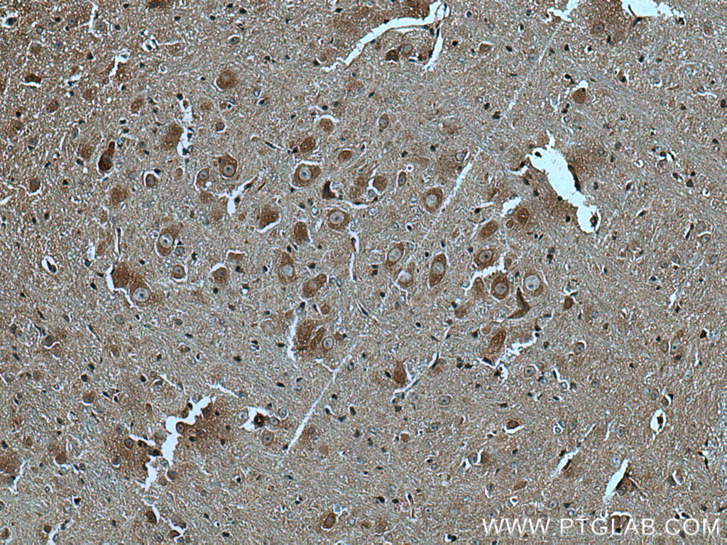 GABBR2 Polyclonal antibody