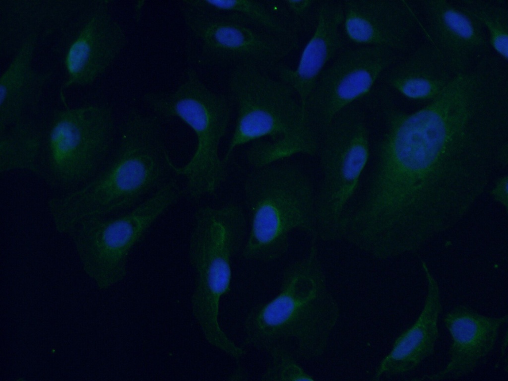 ARPM1 Polyclonal antibody