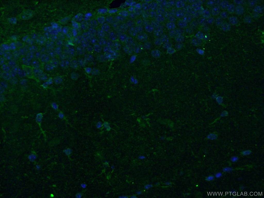 TMEM119 Polyclonal antibody