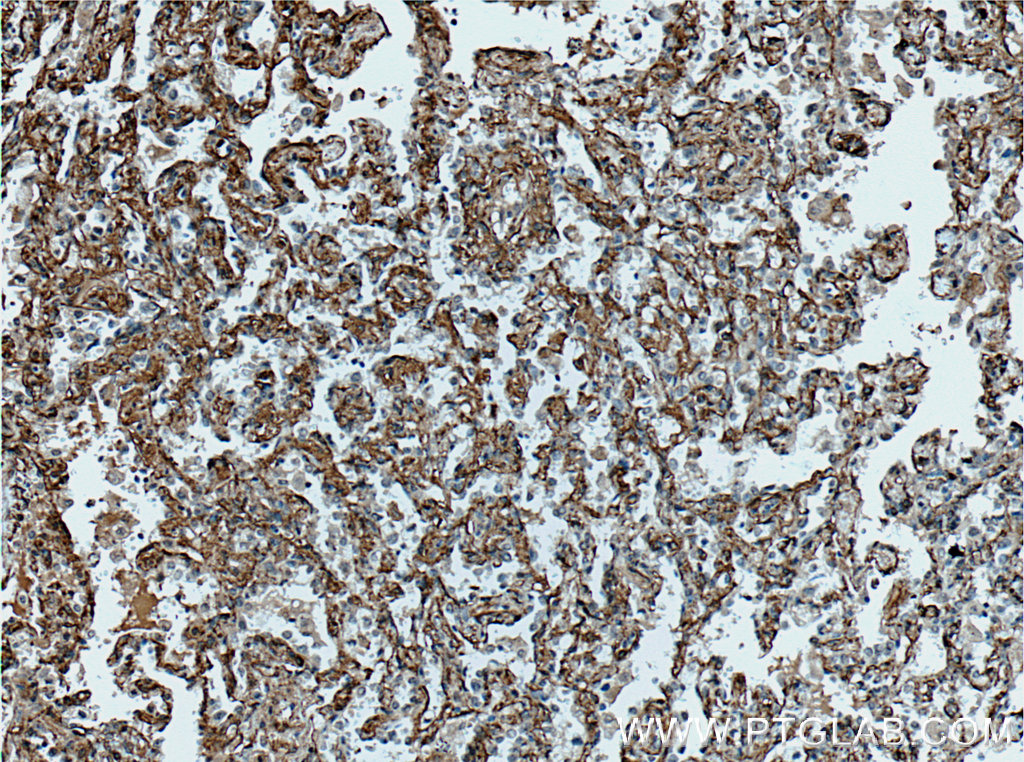 HAI-1 Polyclonal antibody