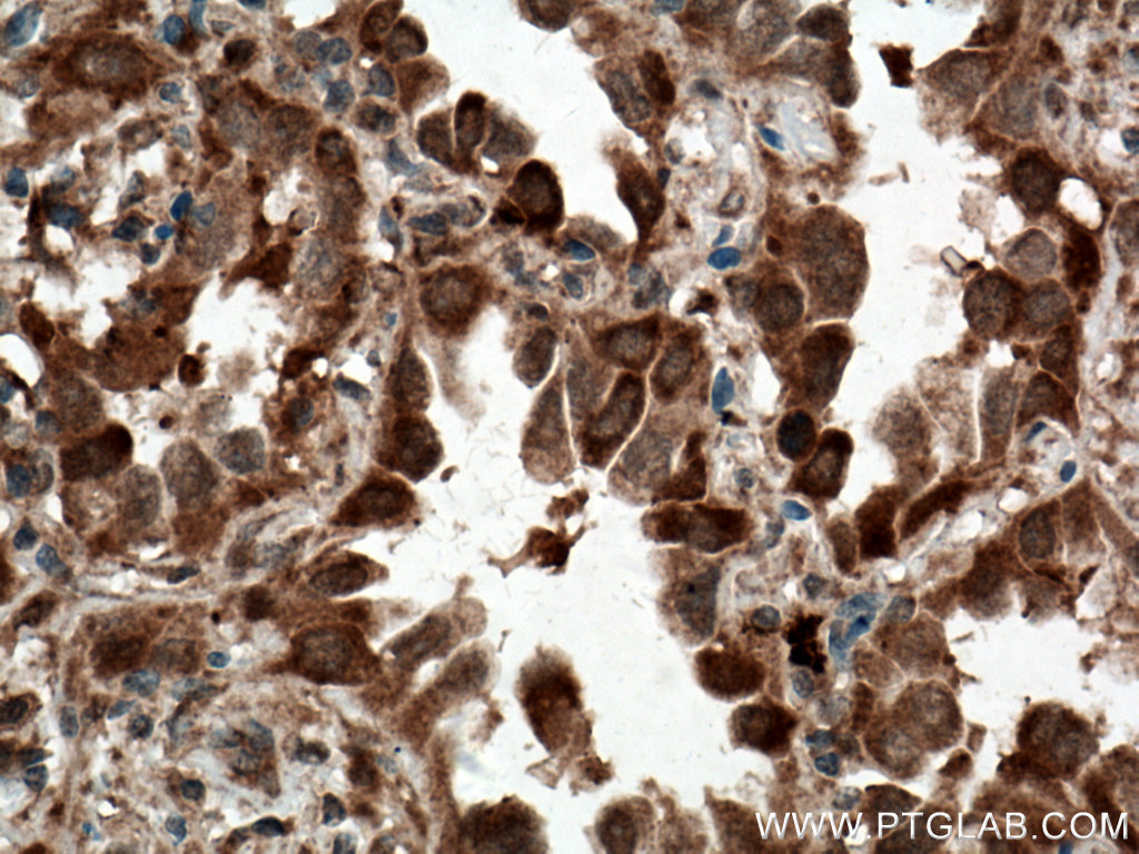 C21orf2 Polyclonal antibody