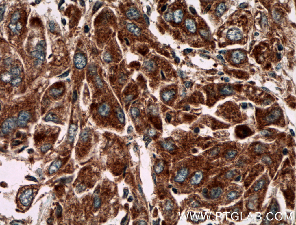 PIP5K1C Polyclonal antibody