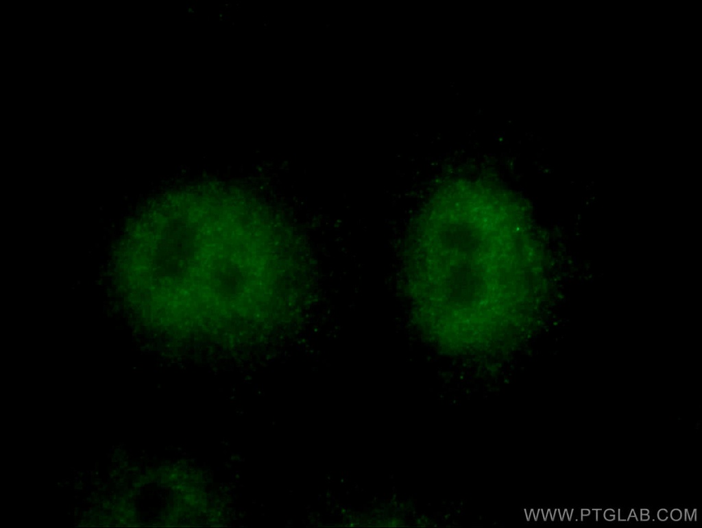 TXNL4A Polyclonal antibody