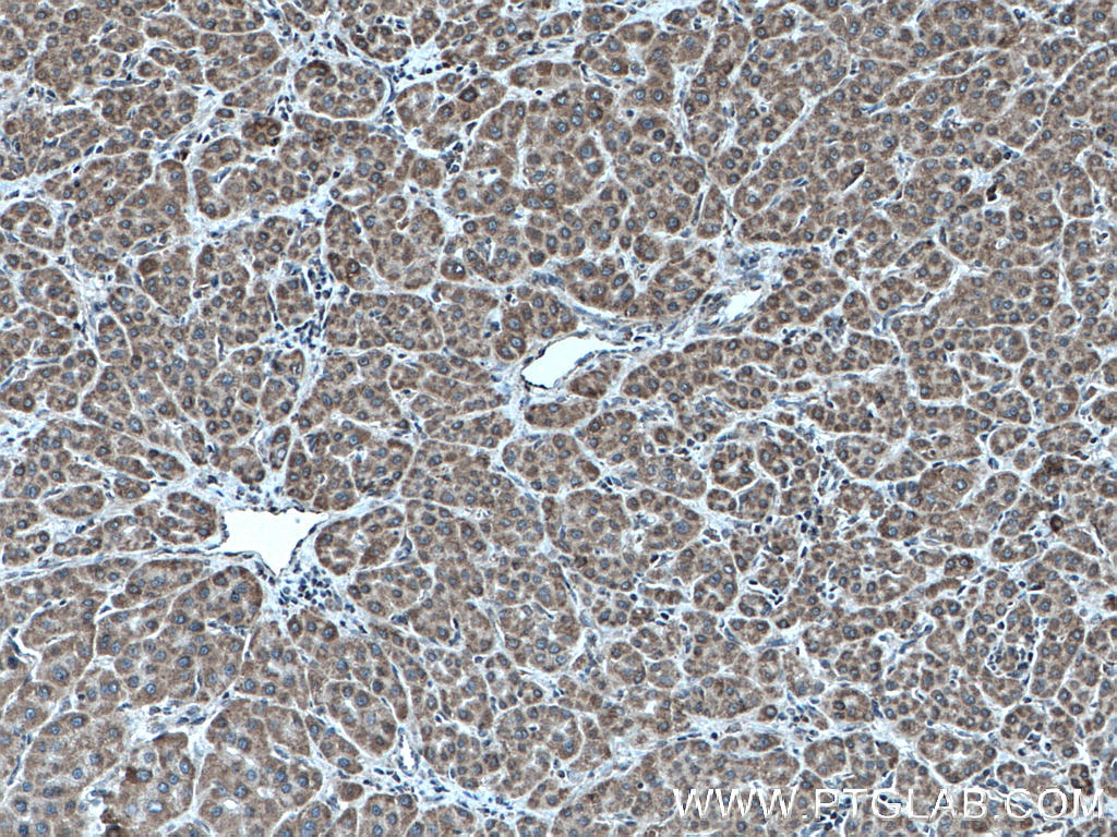 TAPT1 Polyclonal antibody