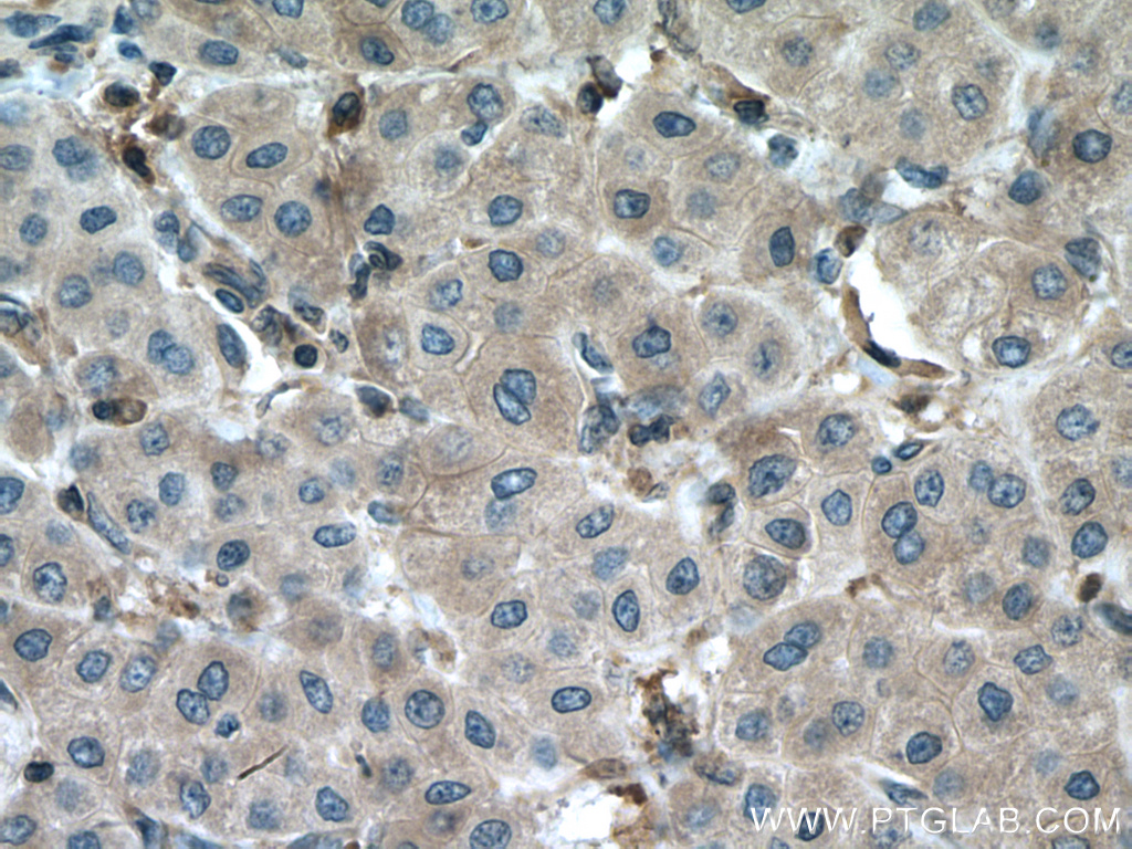 DPYD Polyclonal antibody