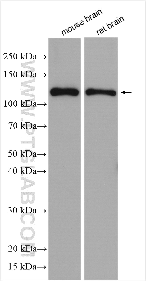 GRIN1 Polyclonal antibody