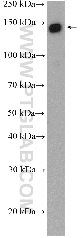 SF3B1 Polyclonal antibody