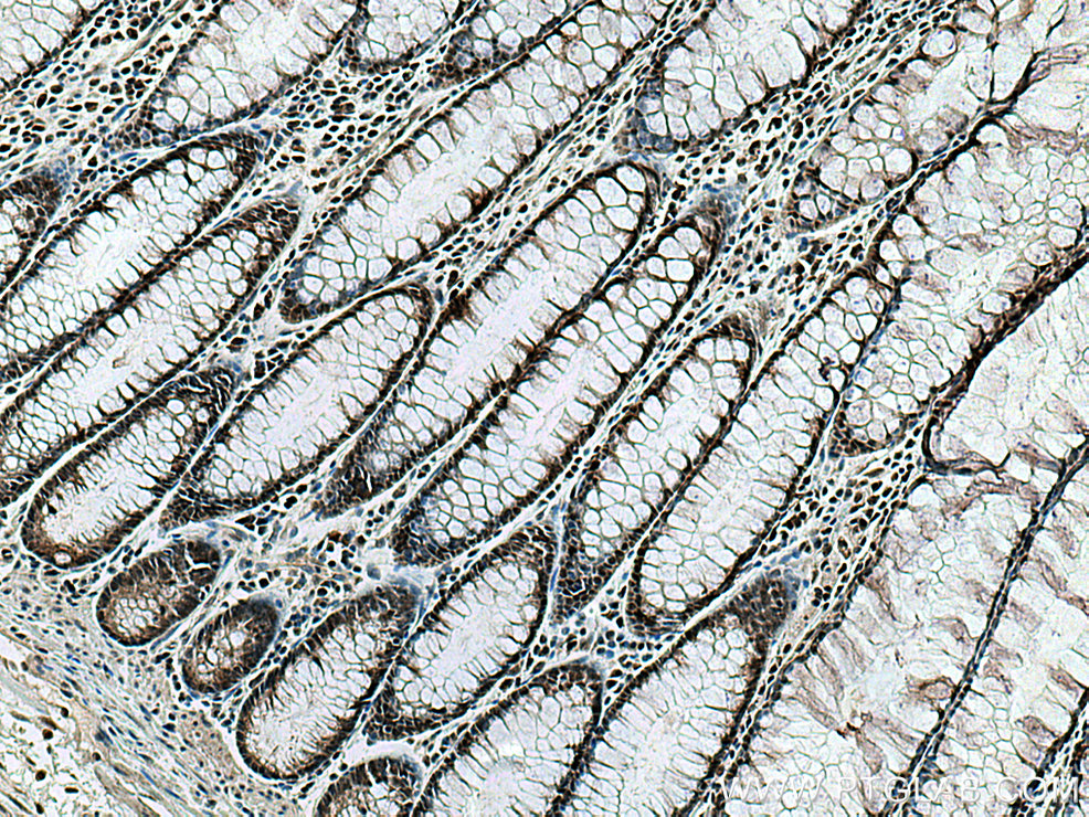 RREB1 Polyclonal antibody