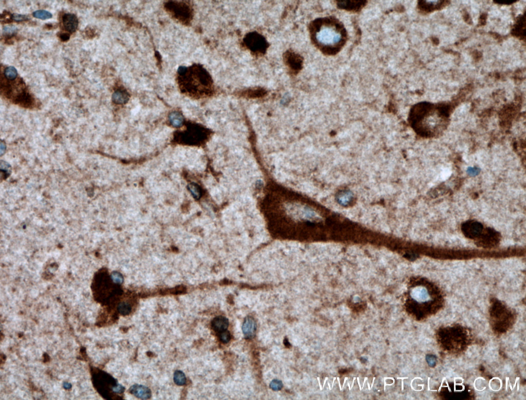 TMEM85 Polyclonal antibody