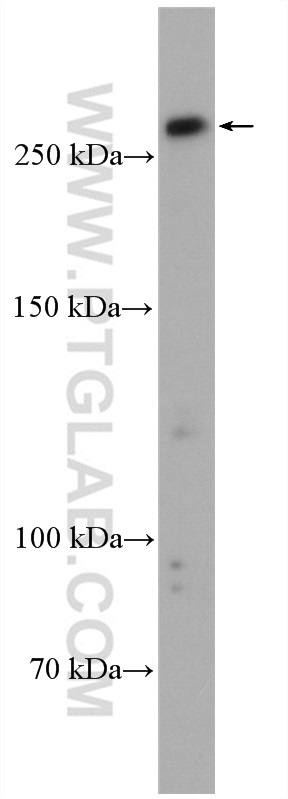PRDM2 Polyclonal antibody