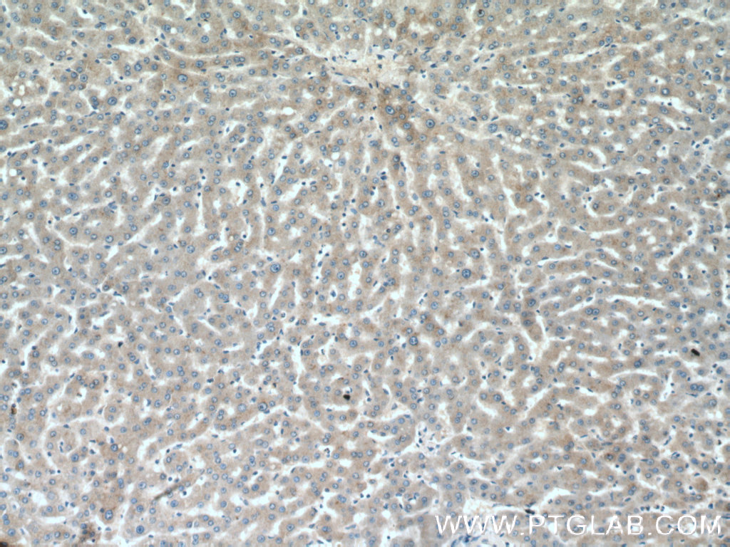 ABCG5 Polyclonal antibody