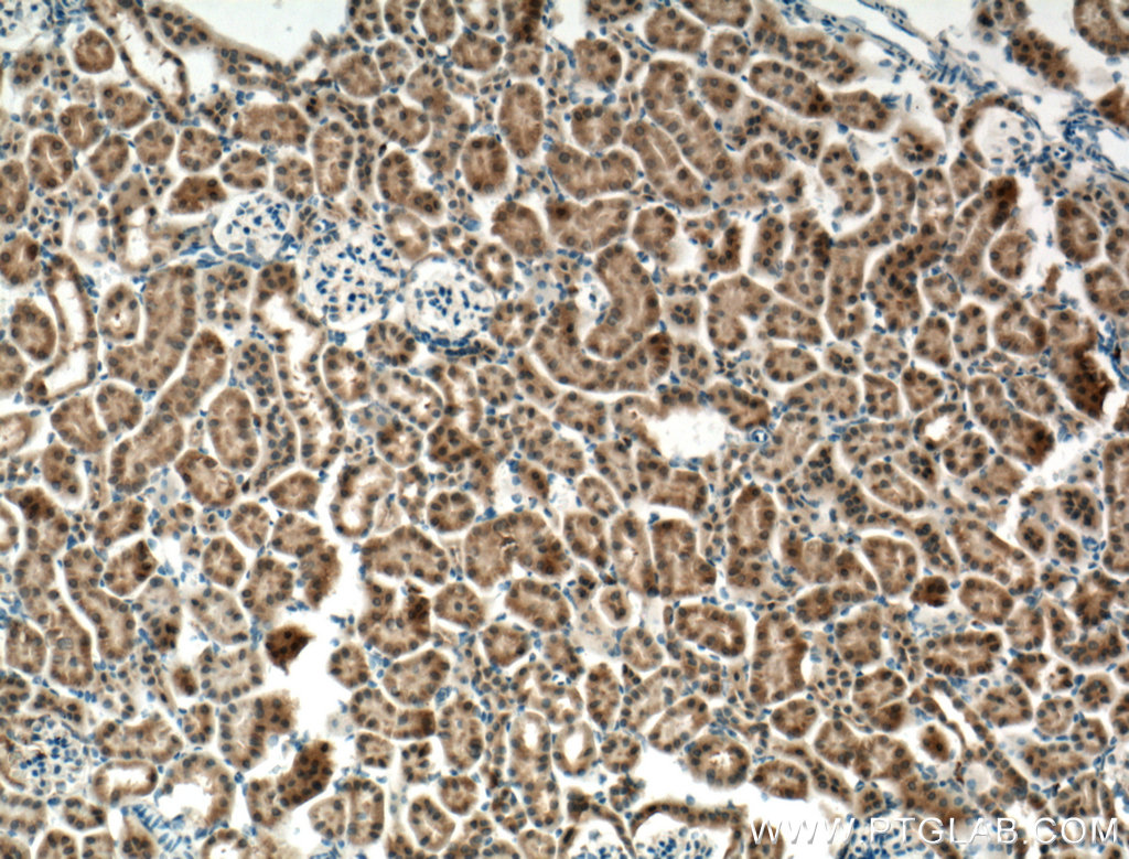 ECHDC1 Polyclonal antibody